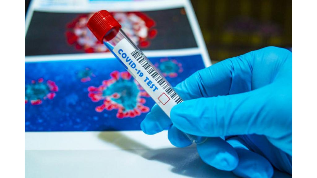 Nova 270 slučaja korona virusa u južnom Banatu