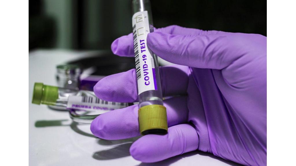 Za 24h u Južnobanatskom okrugu još 336 inficiranih korona virusom