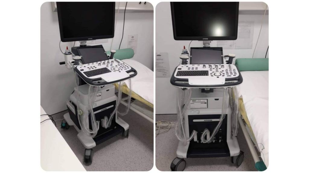 Sredstvima AP Vojvodine Bolnica u Pančevu kupila novi ultrazvučni aparat