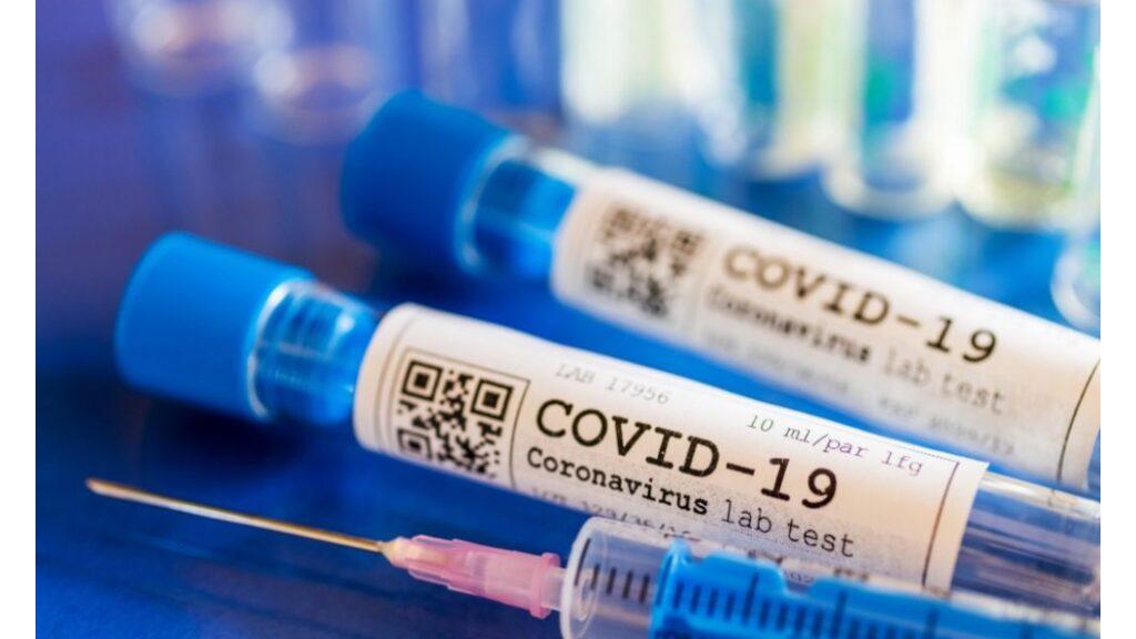 Koronavirusom zaraženo još 948 osoba, preminula 3 pacijenta