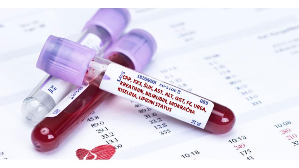 Besplatne analize krvi za sve dobrovoljne davaoce 