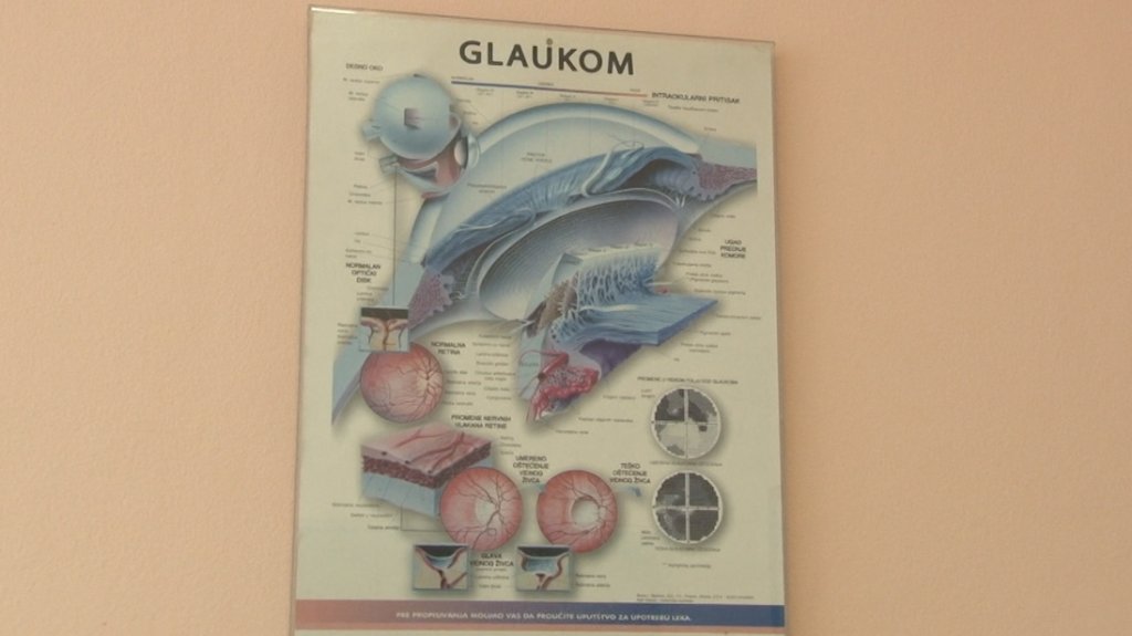 Glaukom je važno otkriti na vreme jer je terapija doživotna