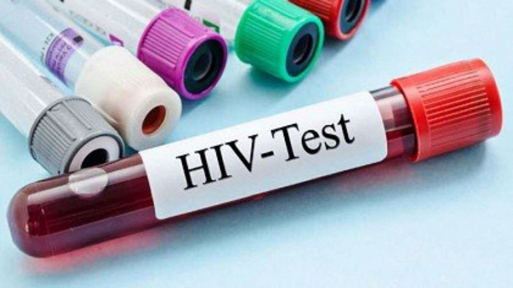 Besplatno testiranje na HIV u savetovalištu „Stav+”